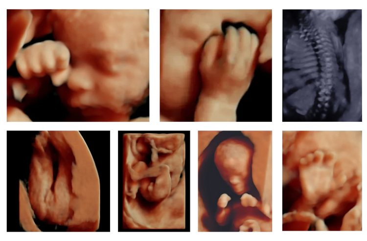Obstetricia