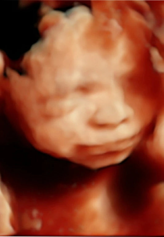 Ultrasonido Obstétrico 4D HD