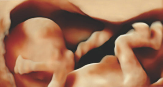 Marcadores Cromosómicos con Duo Test