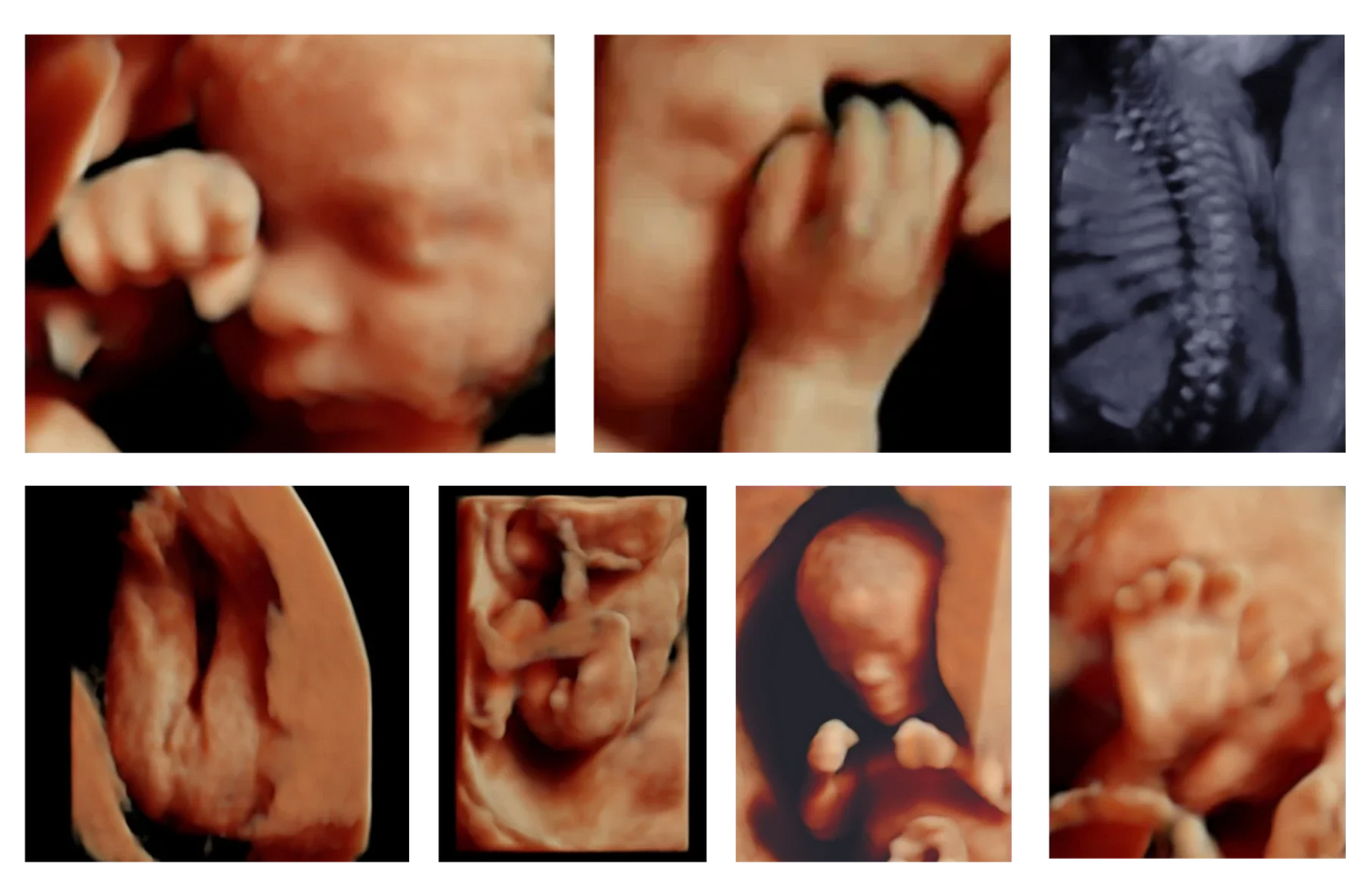 Obstetricia