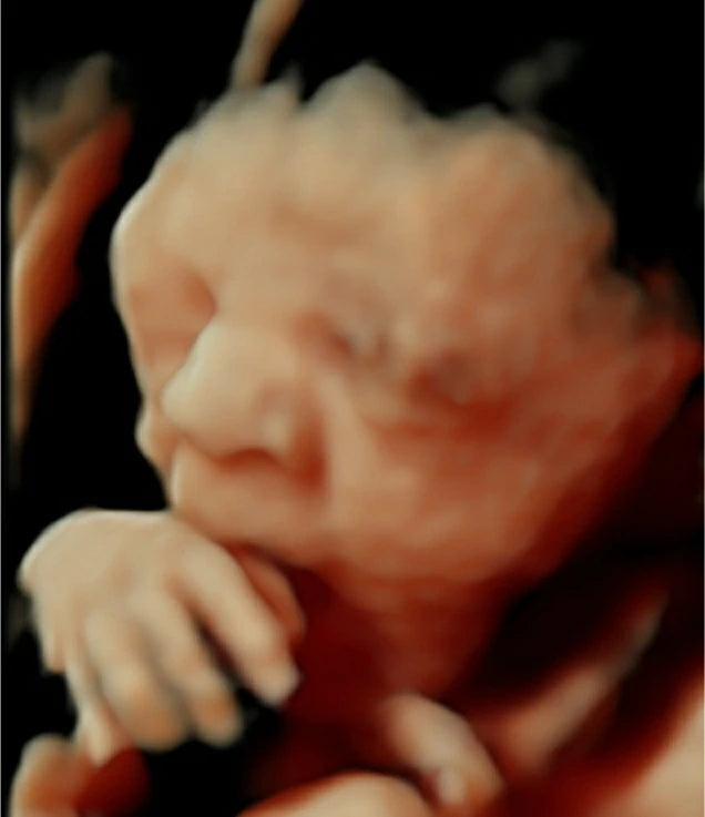 Ultrasonido Obstétrico 4D HD