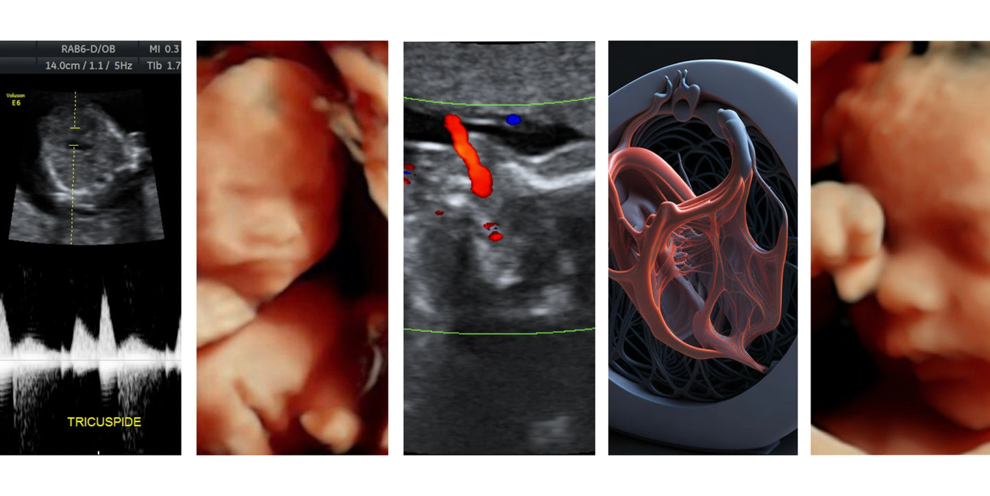 Ultrasonido Estructural 4D del Segundo Trimestre