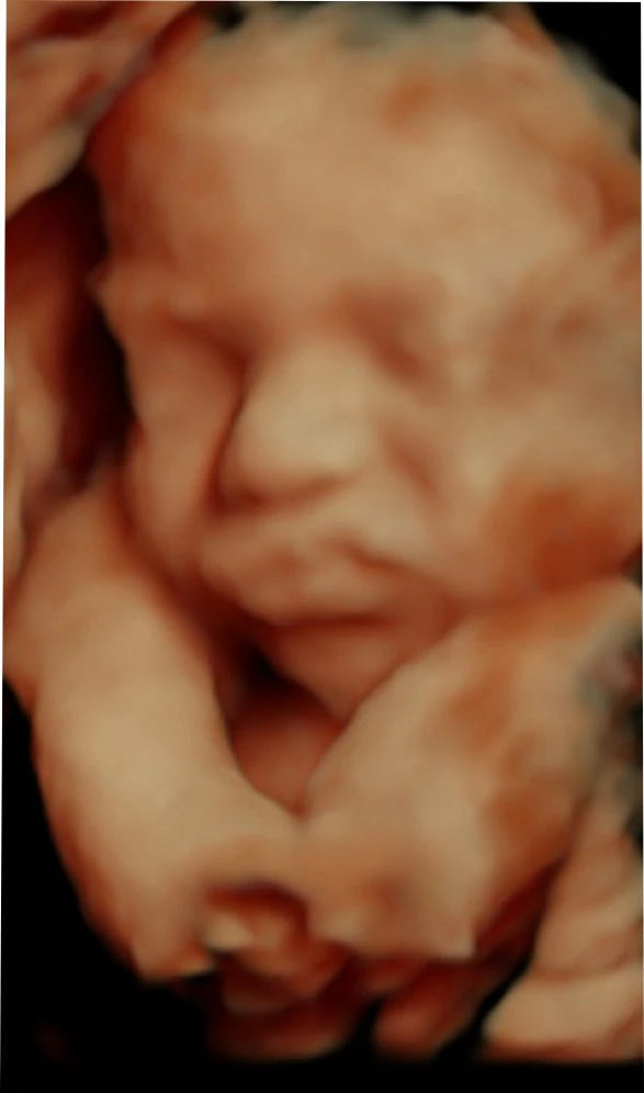 Ultrasonido Obstétrico 4D HD