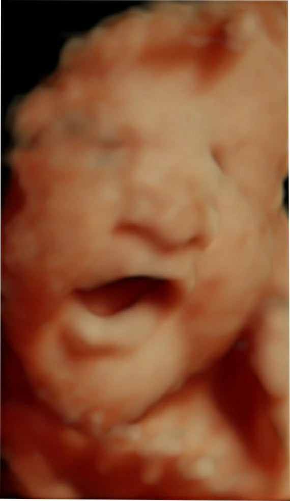 Ultrasonido Obstétrico 4D HD