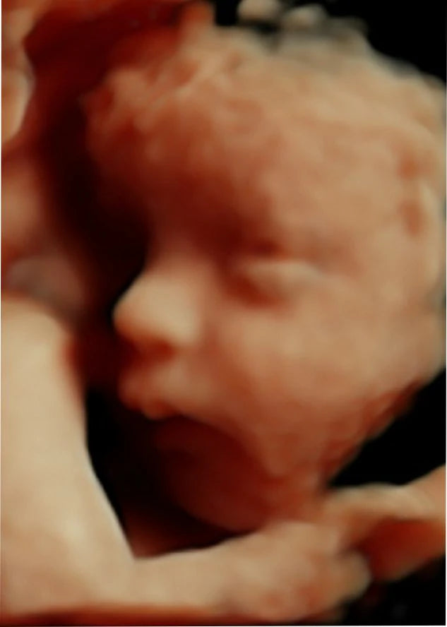 Ultrasonido Estructural 4D del Segundo Trimestre