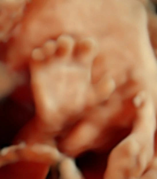 Ultrasonido Estructural 4D del Segundo Trimestre